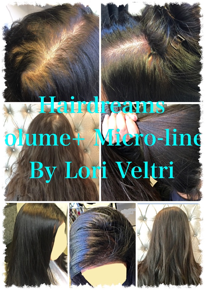 Hairdreams Volume + MicroLines Lori Veltri For Hair Loss
